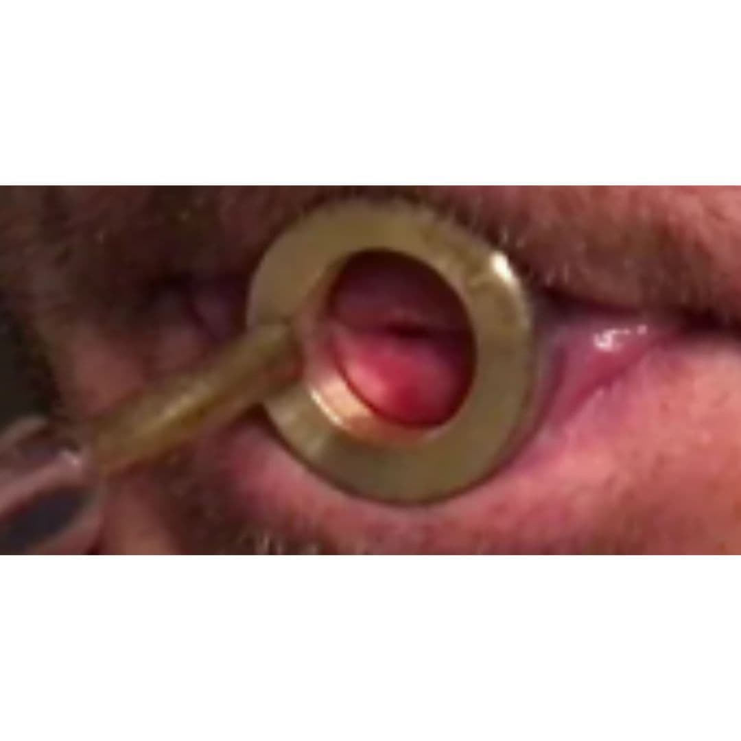 VISUALISATION placement de l'embouchure